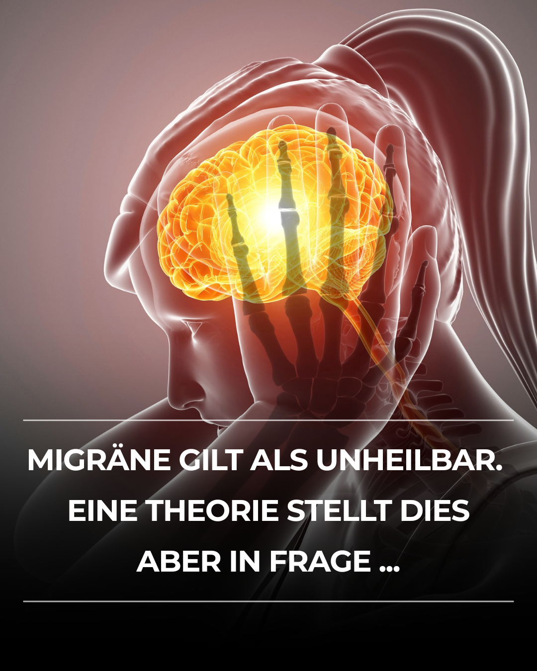 Migräne heilbar? Was Keto-Carnivore wirklich bewirkt
