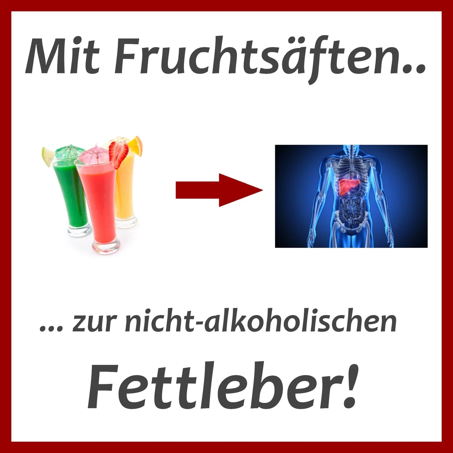 Nicht-alkoholische Fettleber