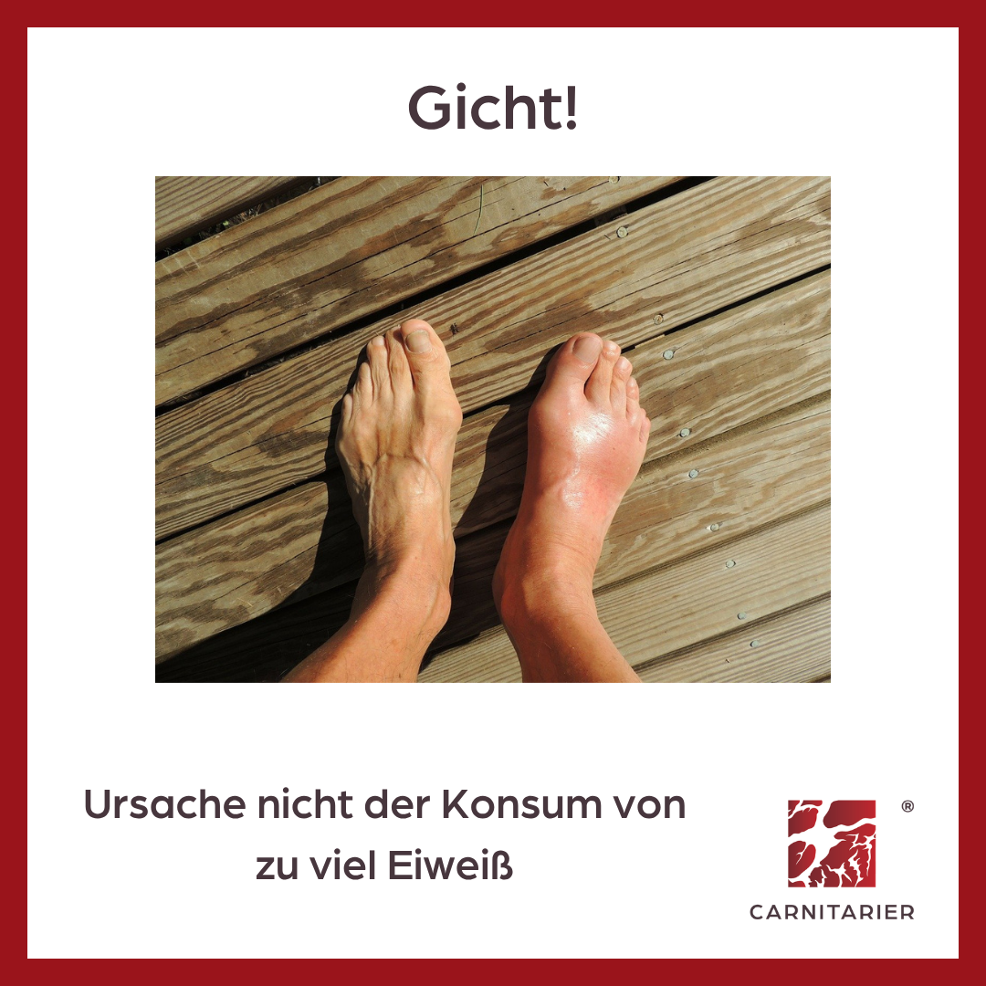 Gicht!